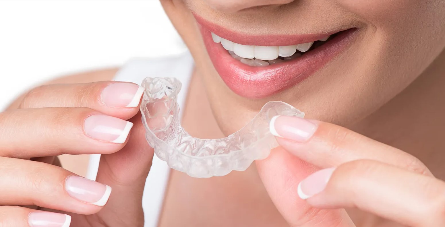 Trattamento Invisalign: tutto quello che devi sapere sugli aligner trasparenti